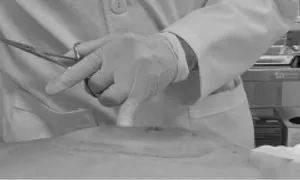 Vết ong đốt nhiễm trùng mới biết mắc bệnh tiểu đường